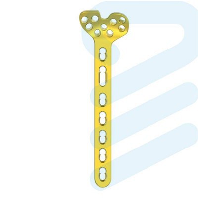 ڈسٹل رداس متغیر زاویہ پلیٹ