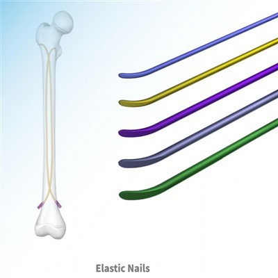 لچکدار انٹرامیڈولری کیل