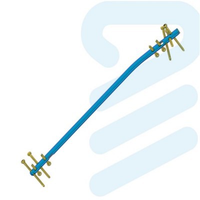 انٹرامیڈولری انٹلاکنگ نیل ٹیبیا