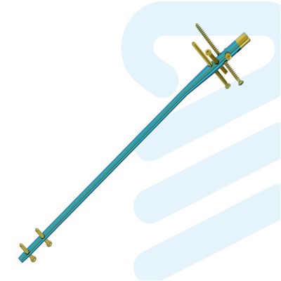 ٹائٹینیم انٹرامیڈولری کیل